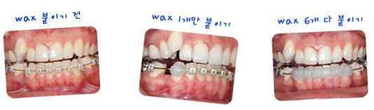 waxx.jpg