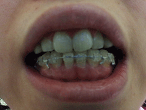 20130131_front.gif