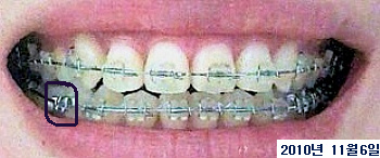 20101106.jpg
