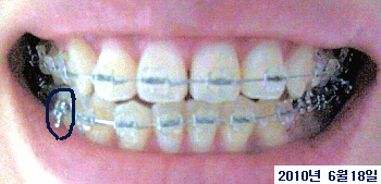 20100618.jpg