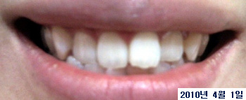 20100401.jpg