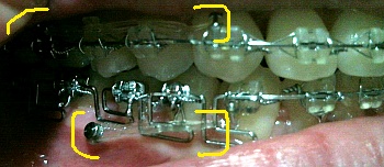 20110202.jpg
