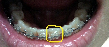 20110110.jpg