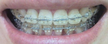 201108051.jpg