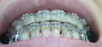 201108056.jpg