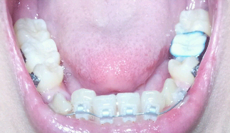 2012-03-05 19.36.43_1.jpg