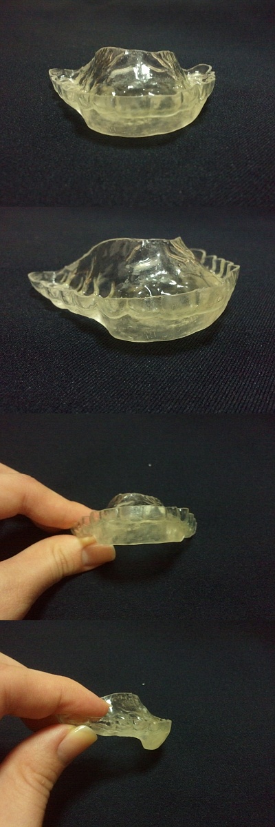 splint.jpg
