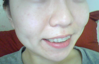 20101113.jpg