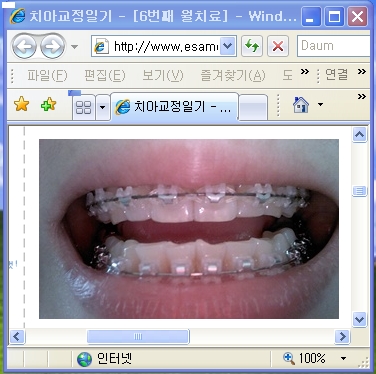 after.JPG