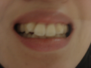 tooth1.jpg