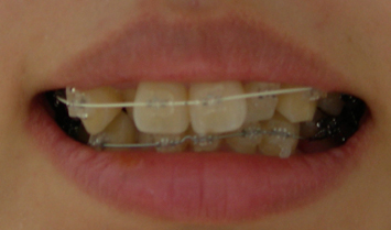 20100617.jpg