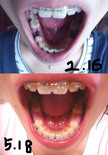 20120518230835_60494990.jpg