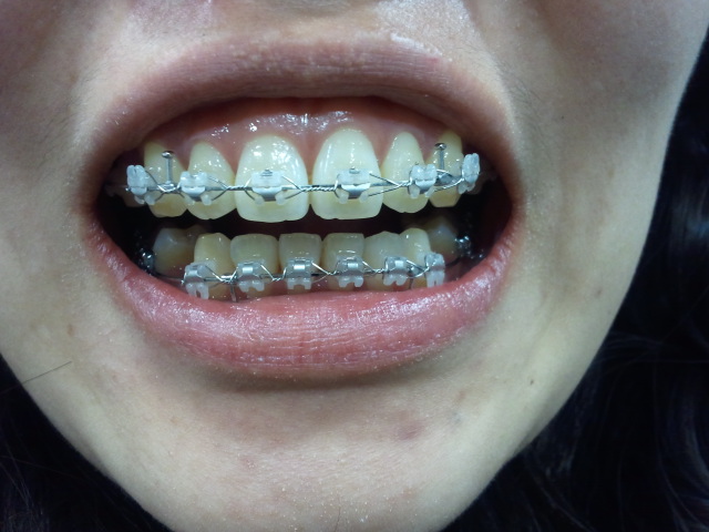 2012-02-28 17.59.38.jpg