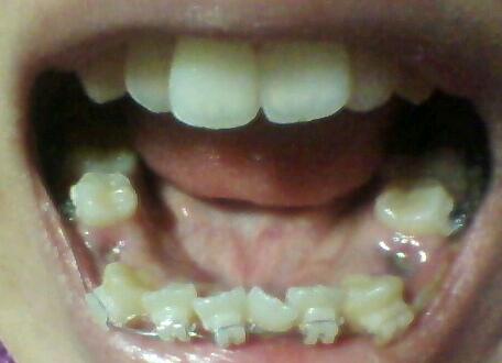 20110420.jpg