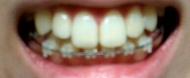 20111007.jpg