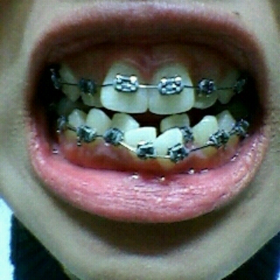 못생.jpg