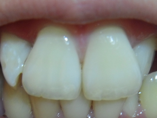 SDC10574.JPG