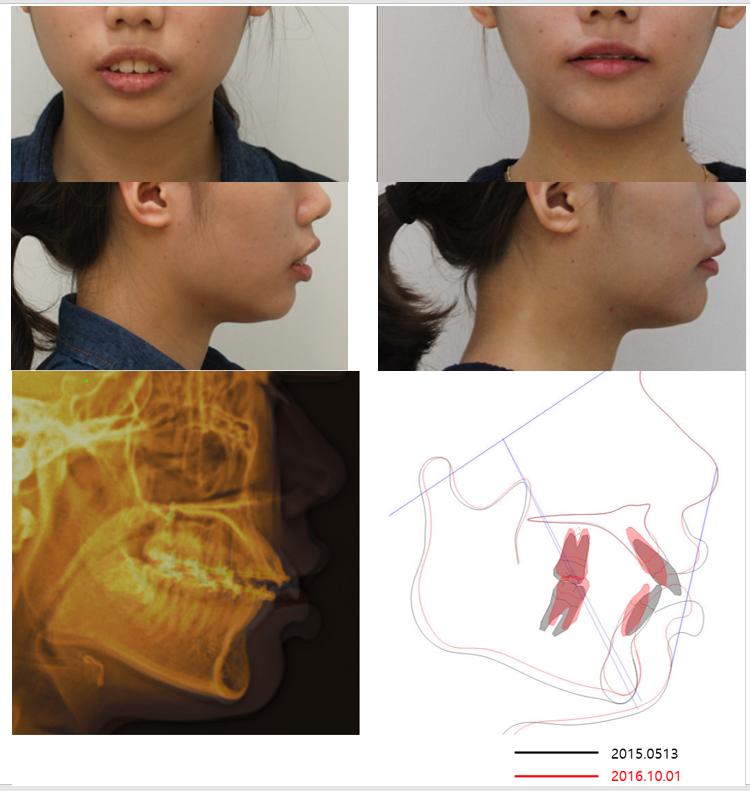캡처4.PNG.jpg